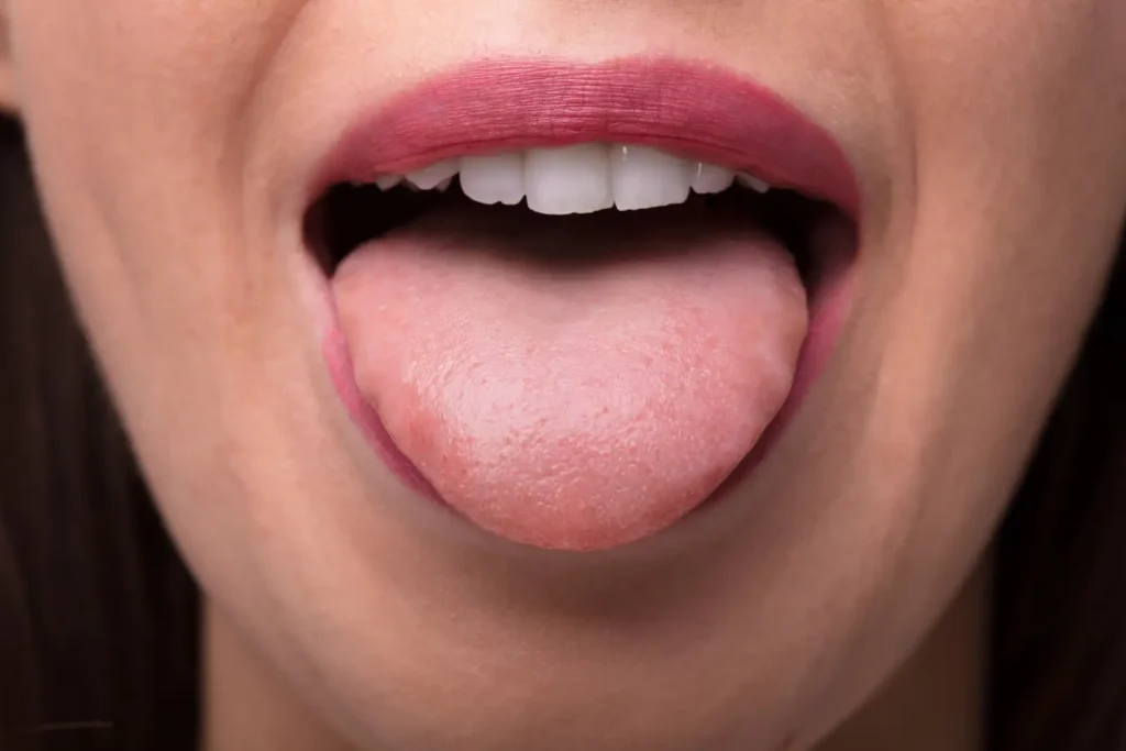 what your tongue can tell you about your health