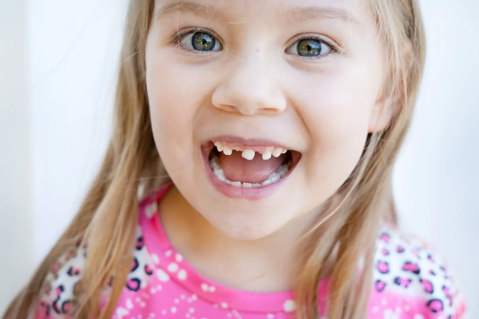 Is It Ok To Pull Loose Teeth?